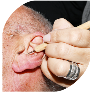 la-réflexologie-auriculaire-stimulation-par-stylet